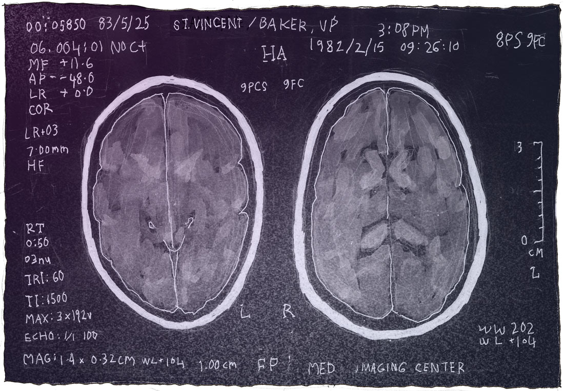 the inbetweener: brain scans